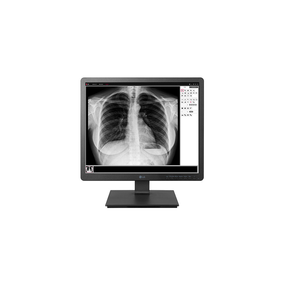 LG 19HK312C-B écran plat de PC 48,3 cm (19") 1280 x 1024 pixels SXGA Noir LG 19HK312C-B écran plat de PC 48,3 cm (19") 1280 x 1024 pixels SXGA Noir